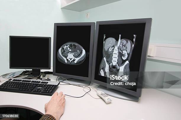 Radiologo Esaminando Gatto Scansione Delle Immagini Su Monitor - Fotografie stock e altre immagini di Attrezzatura