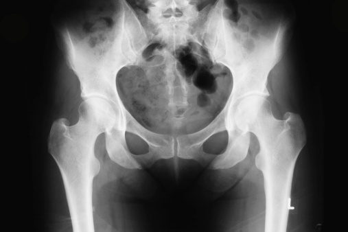 X-ray of human abdomen