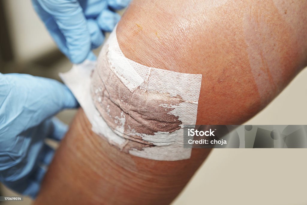 Enfermeira está mudando para uma faixa de feridos paciente do joelho - Foto de stock de Bandagem royalty-free
