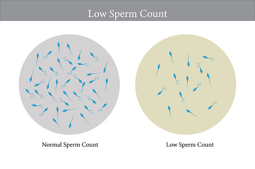 normal and low sperm count illustration. Male infertility oligospermia. Structure of the sperm. Vector. eps 10