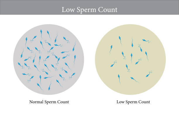 Print normal and low sperm count illustration. Male infertility oligospermia. Structure of the sperm. Vector. eps 10 tadpole swimming stock illustrations