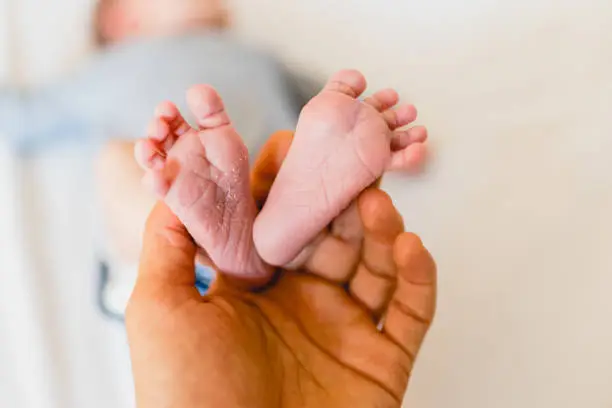 Newborn feet skinning held by mommy