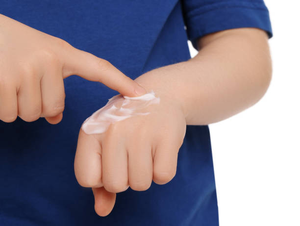 istock Child applying ointment onto hand isolated on white, closeup 1707089780