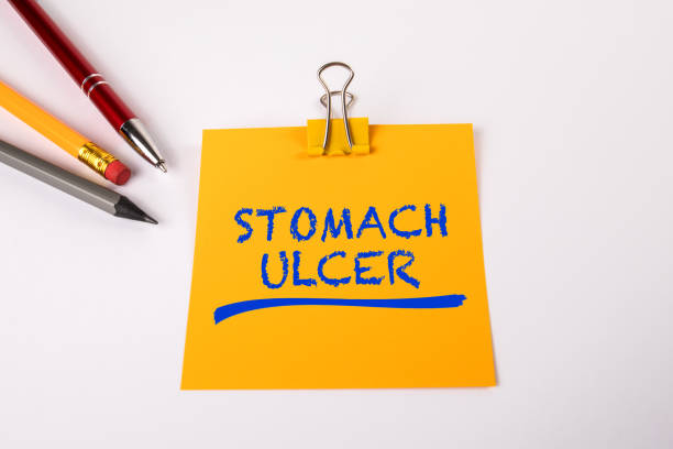 istock STOMACH ULCER. Yellow notepad and pen on white office table 1707916330