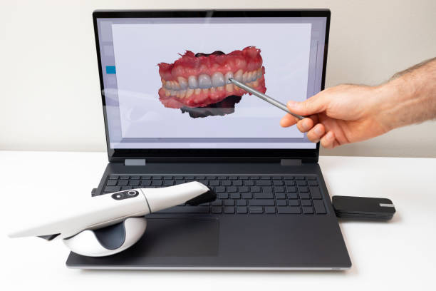 zahnarzt zeigt 3d-gescanntes bild von gescannten zähnen auf dem monitor des computers. weißer 3d-intraoral-zahnscanner, der auf dem tisch liegt. zahnärztliche geräte, gerät zum scannen von zähnen. zahnmedizin. horizontal - machine teeth fotos stock-fotos und bilder