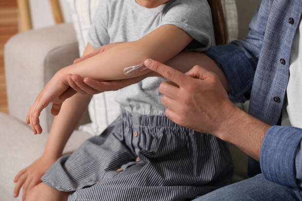istock Father applying ointment onto his daughter's elbow on couch, closeup 1709003749