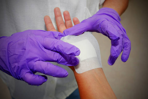 istock Patient after carpal tunnel syndrome operation at plastic surgery 171136061