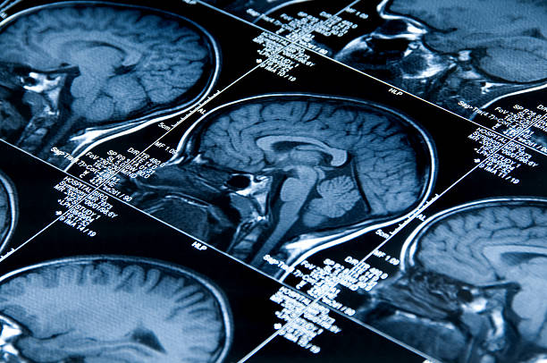 mri brain scan showing multiple images of head and skull - brain scan' bildbanksfoton och bilder
