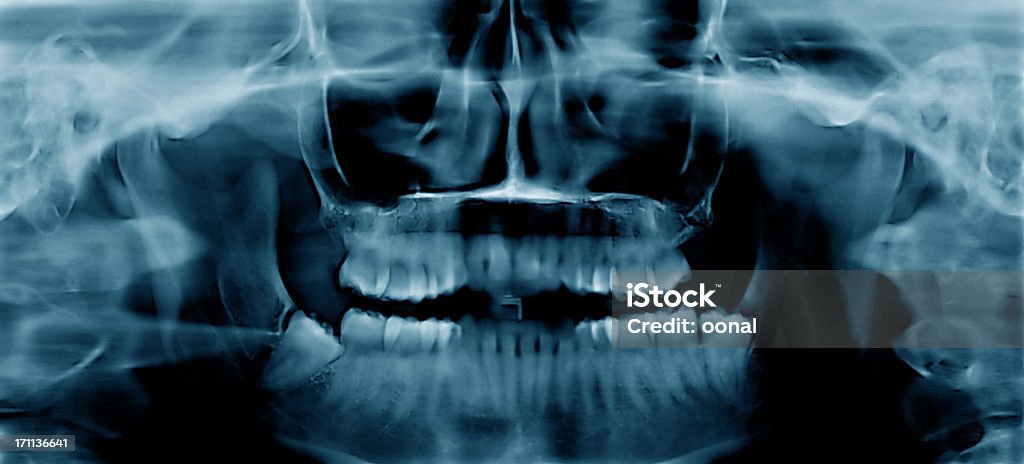 치과 X-선 - 로열티 프리 엑스레이 이미지 스톡 사진