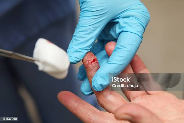 Krankenschwester Ist Die Änderung Bandage Zu Einem Verletzten Patientenfinger Stockfoto und mehr Bilder von Bandage