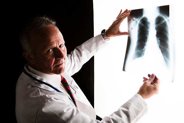 x-ray badanie - x ray chest human lung rib cage zdjęcia i obrazy z banku zdjęć