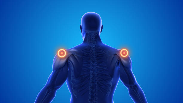 relieve shoulder pain Shoulder Bone bursitis ripl fitness