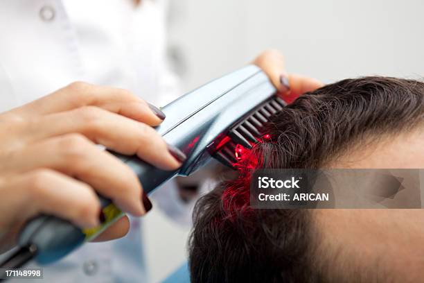 Hair Therapy Stock Photo - Download Image Now - Laser, Hairbrush, Hair Loss