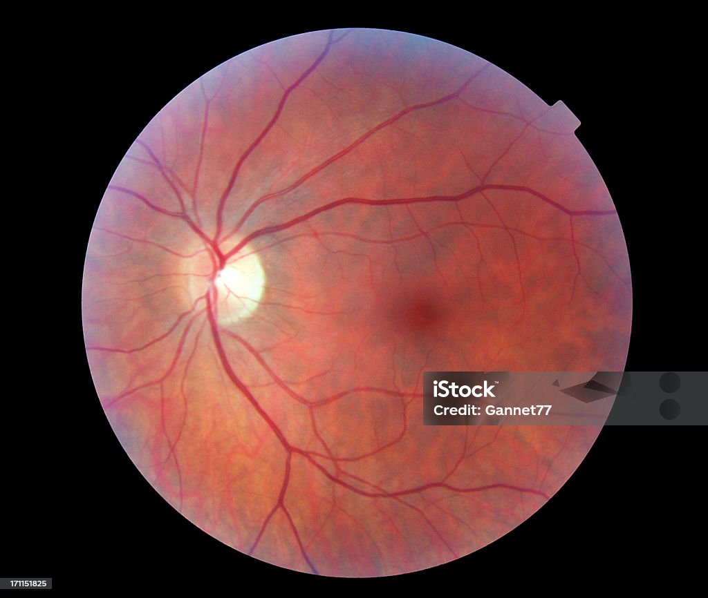 Imagen de la Retina humanos - Foto de stock de Retina libre de derechos