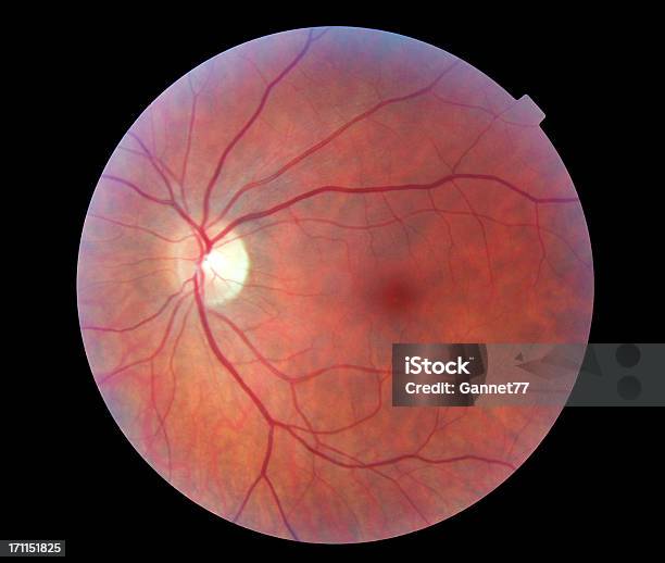 Image Of A Human Retina Stock Photo - Download Image Now - Retina, Eye, Retinal Scan