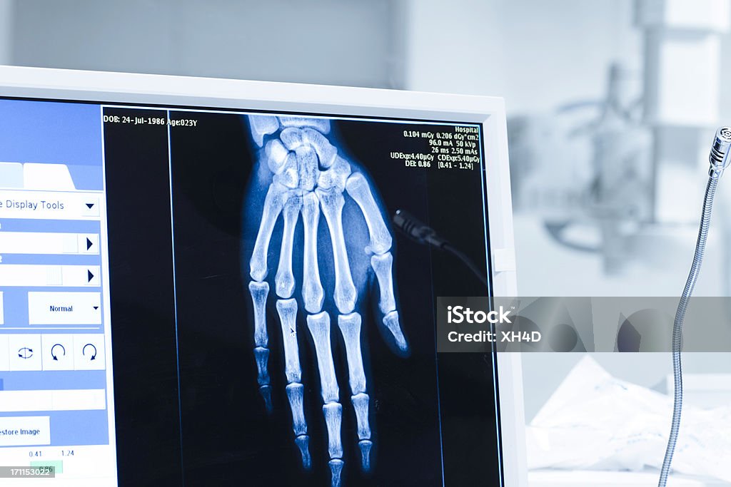 Analisar raios x ou scann radiografia no hospital - Royalty-free Imagem de raios X Foto de stock