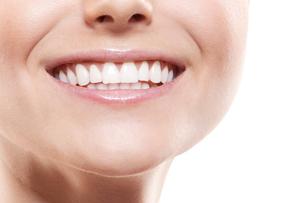 istock Smiling woman mouth with great teeth. 171153454