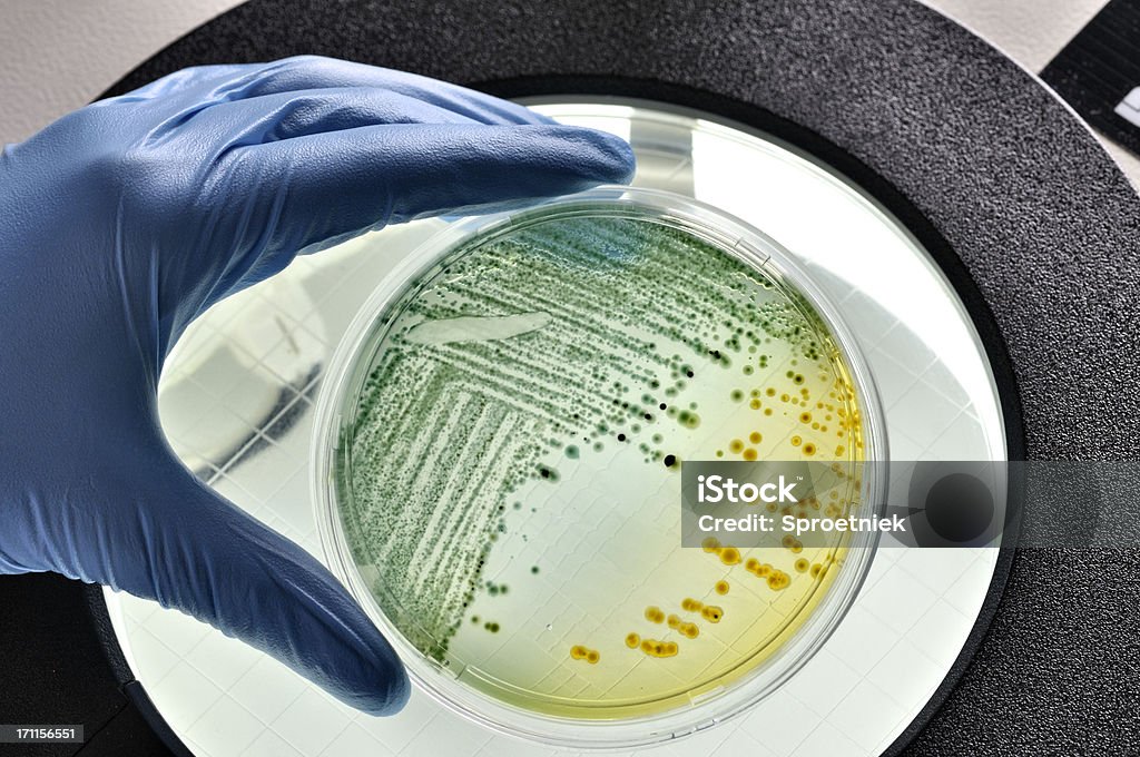 E.coli bacteria growing in dish E. coli bacteria growing in laboratory dish inspected in a food laboratory E. coli Stock Photo