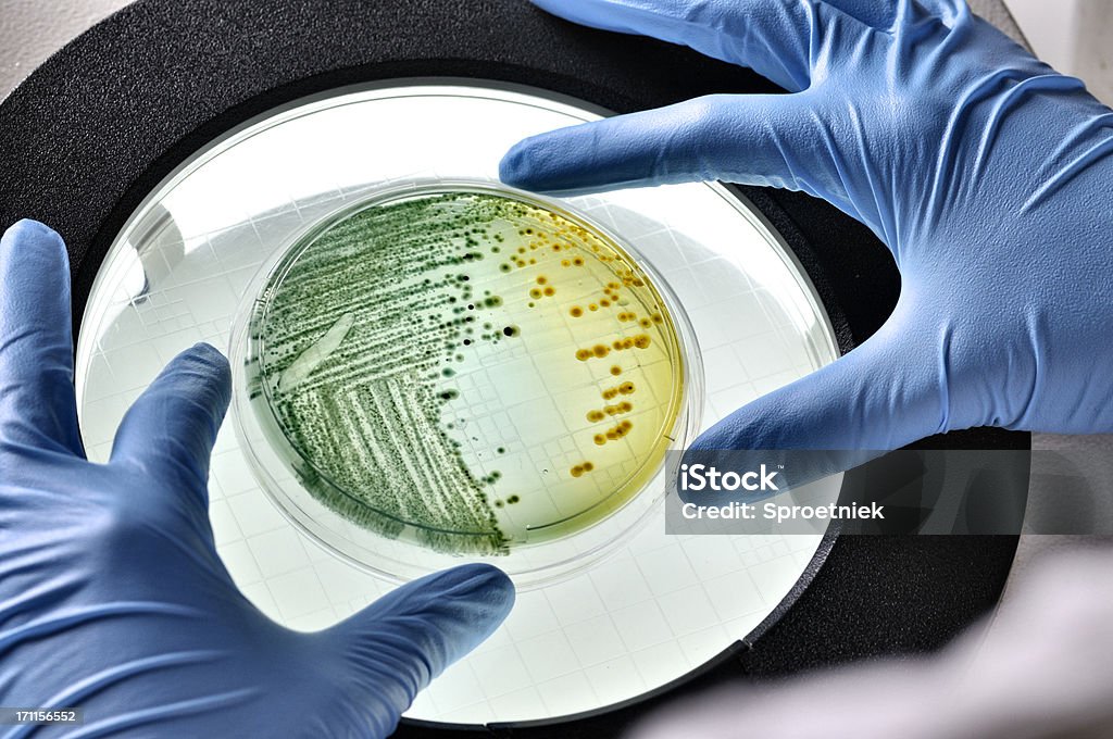 Bactérie E.coli croissance de l'inspection plat - Photo de Laboratoire de séparation des liquides libre de droits