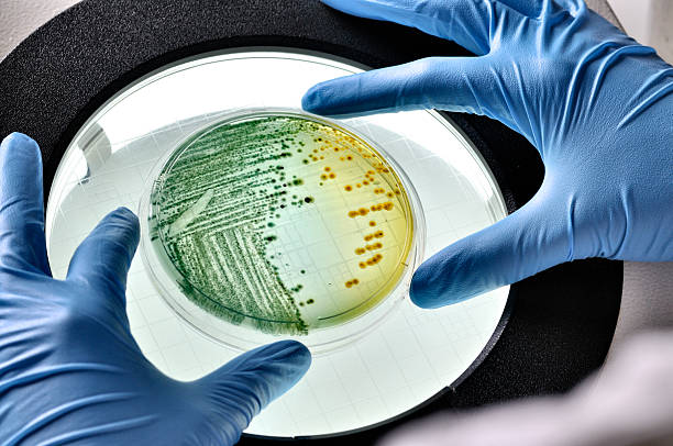 e.coli crescimento da bactéria prato inspecionado - separating laboratory - fotografias e filmes do acervo