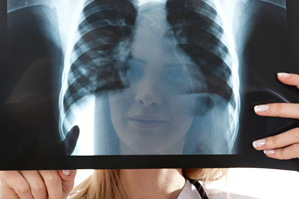 istock Female doctor examining an x-ray image 171159110