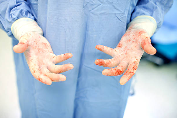 Doctor's bloody hands stock photo