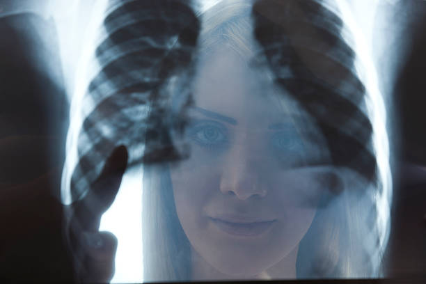 istock Female doctor examining an x-ray image 171159375