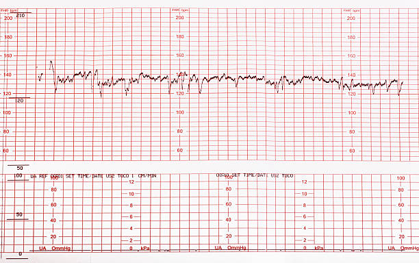 医療チャート - pulse trace surveillance machine healthcare and medicine ストックフォトと画像