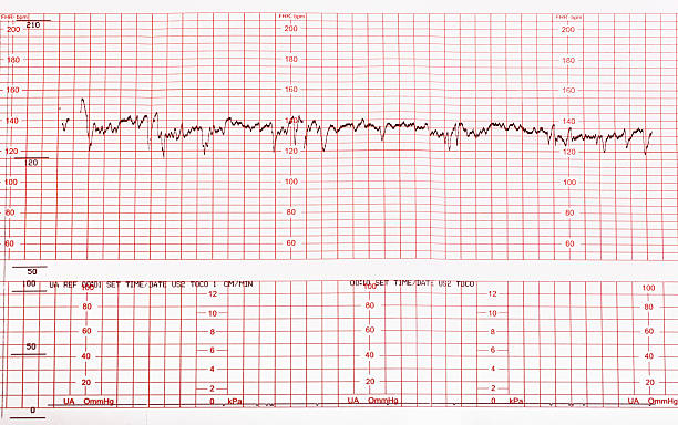 Medical cardiogram chart with results