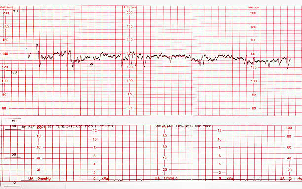 Medical cardiogram chart with results Medical chart electrocardiogram diagnostics stock pictures, royalty-free photos & images