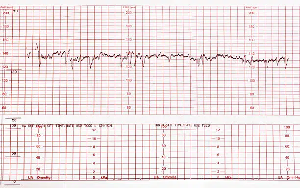 Photo of Medical cardiogram chart with results