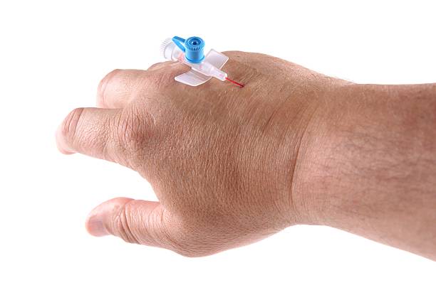 istock Intravenous cannula, Venflon founded on men's hand 171237720