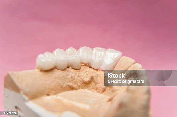Prótese Dentária - Fotografias de stock e mais imagens de Artificial - Artificial, Colorido, Cor de rosa