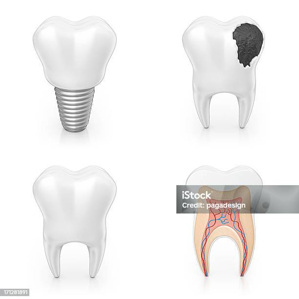 Tooth Icons Stock Photo - Download Image Now - Three Dimensional, Illness, Anatomy