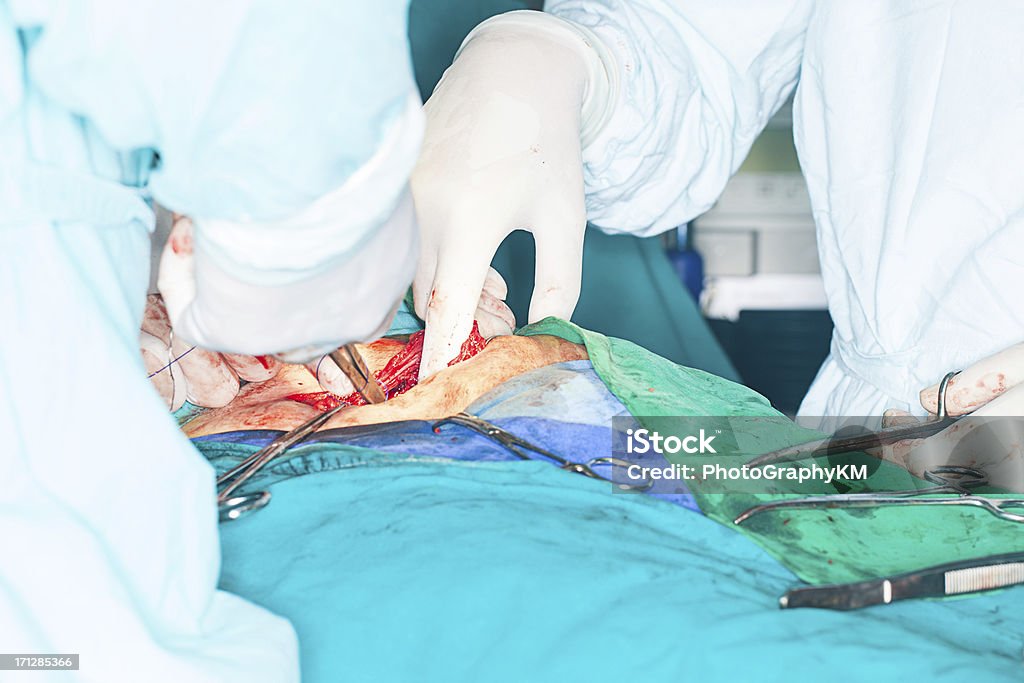 Inguinal Hernia Chirurgie - Lizenzfrei Drahtnetz Stock-Foto