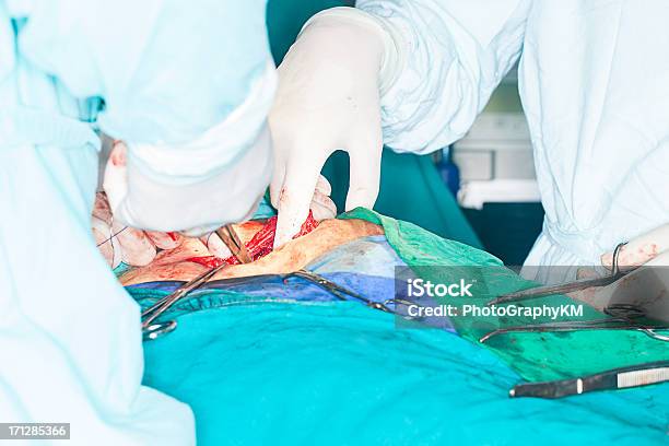 Inguinal Hernia Chirurgie Stockfoto und mehr Bilder von Drahtnetz - Drahtnetz, Eingeweidebruch, Gitter