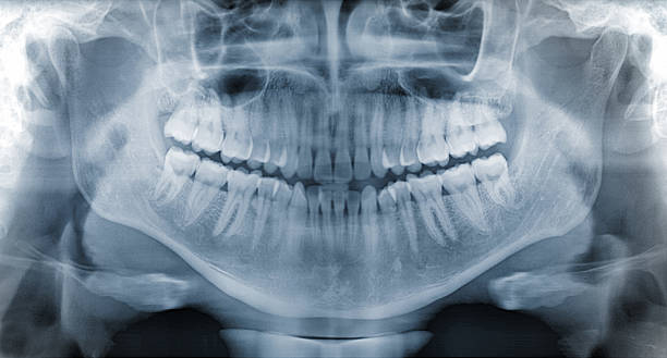 パノラマに広がる歯科 x 線 - medical scan 写真 ストックフォトと画像