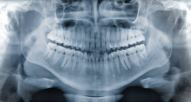 Panoramic dental x-ray Panoramic dental x-ray film of  a healthy jaw. human teeth photos stock pictures, royalty-free photos & images