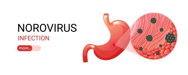 zakażenie żołądka i norowirusa pod sztandarem powiększenia - norovirus diarrhea gastroenteritis virus stock illustrations