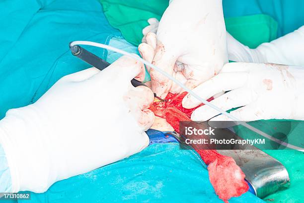 Inguinal Hernia Chirurgie Stockfoto und mehr Bilder von Arzt - Arzt, Bauch, Blut