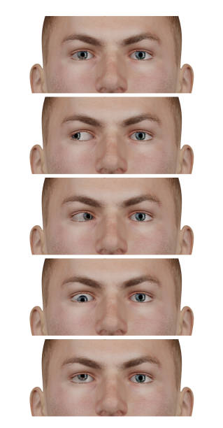 istock Main in close-up exemplifying the types of strabismus 171321068
