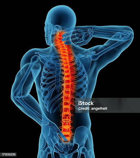 Foto de Anatomia De Um Homem Com Dor Nas Costas e mais fotos de stock de Dor nas Costas - Dor nas Costas, Corpo humano, Homens