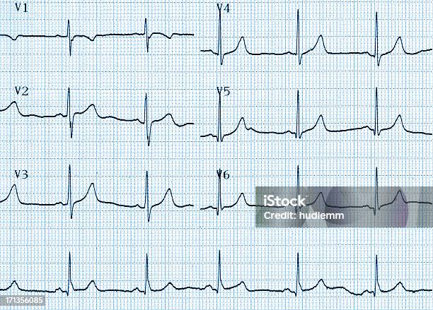 Photo libre de droit de Tableau Cardiogram banque d'images et plus d'images libres de droit de Électroencéphalogramme - Électroencéphalogramme, Diagramme, En papier