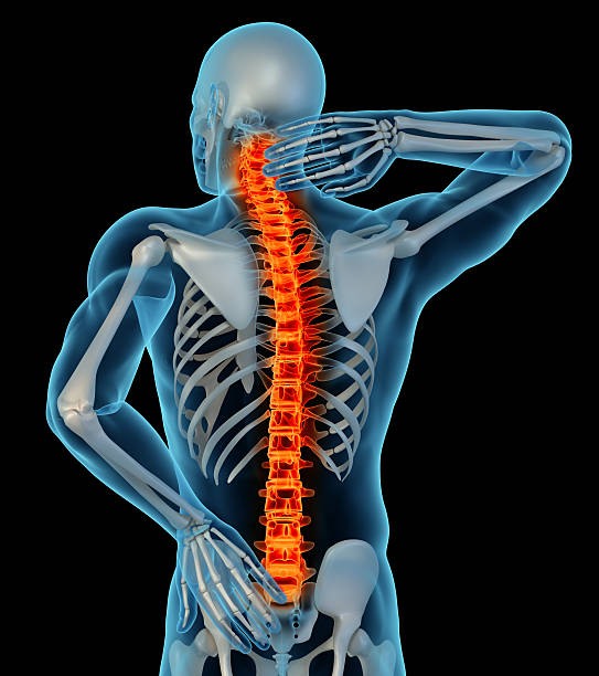 istock Cartoon showing a man with back pain 171358590