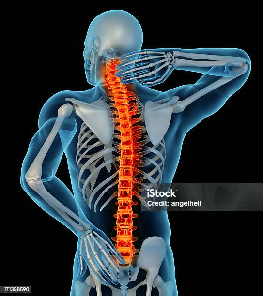 Foto de Anatomia De Um Homem Com Dor Nas Costas e mais fotos de stock de Dor no Pescoço - Dor no Pescoço, Vista Traseira, Dor nas Costas