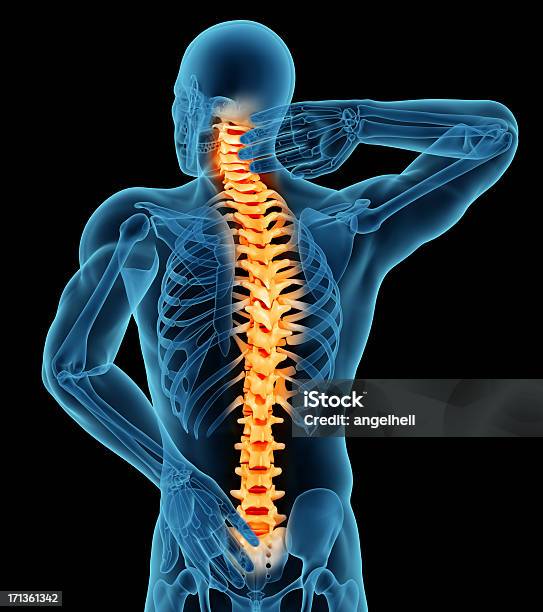 Anatomie Des Mann Mit Rückenschmerzen Stockfoto und mehr Bilder von Schmerz - Schmerz, Rückenschmerzen, Dreidimensional