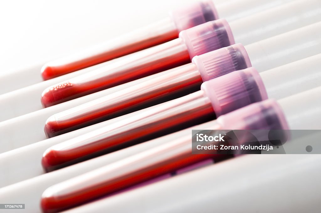 As amostras de sangue (DOF Raso) - Royalty-free Sangue Foto de stock