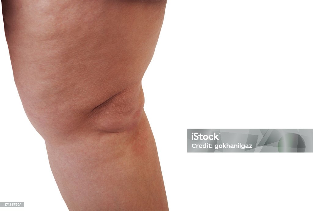 Fat woman leg. Detail of cellulite on woman leg isolated on white. Overweight Stock Photo