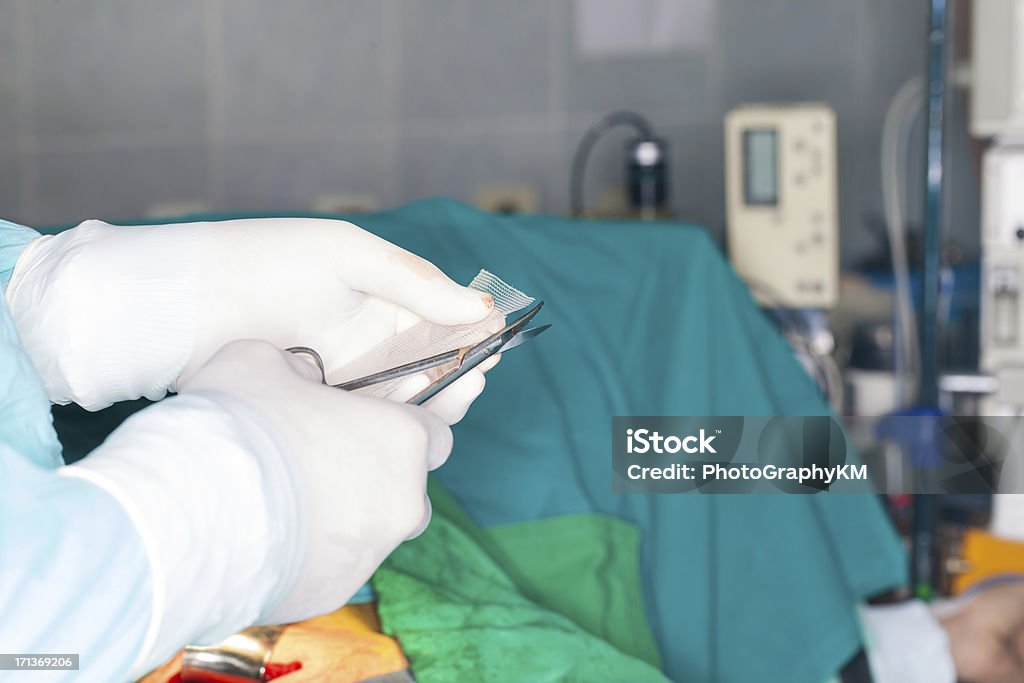 Meshes For Hernia surgeon chops mesh for hernia Wire Mesh Stock Photo