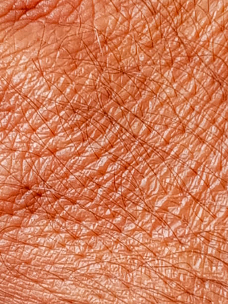 istock Human hand hairy dry skin 1713719749